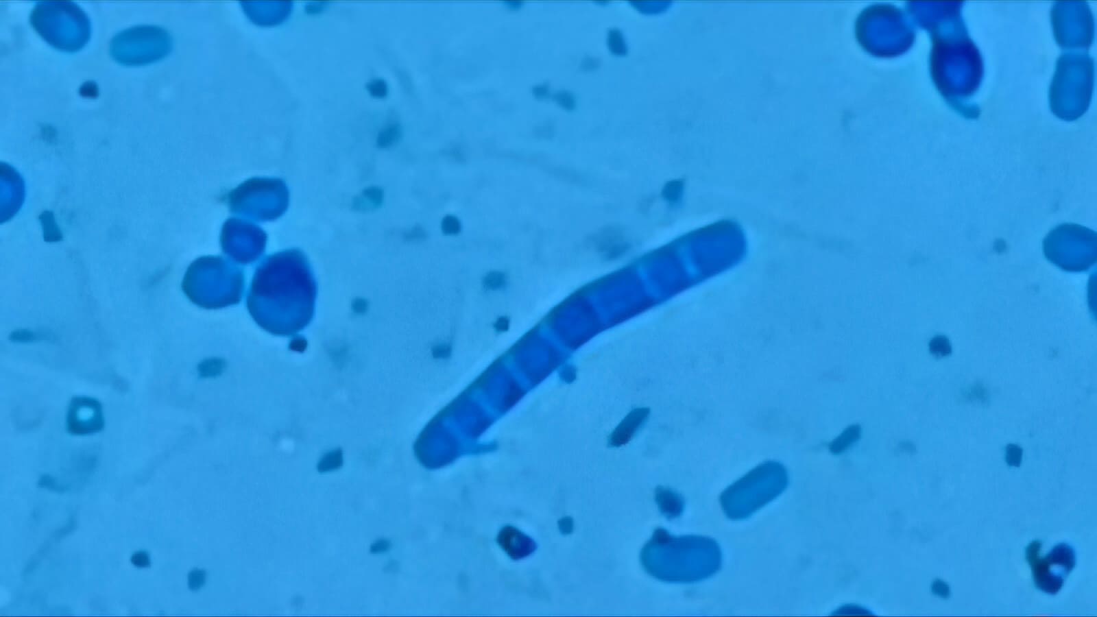 34. Trichophyton Rubrum Macrospores